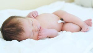 Jenis Masalah Kulit Bayi Baru Lahir