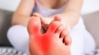 Waspadai! 5 Tanda Asam Urat di Kaki yang Muncul Tiba-tiba