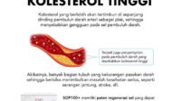 Kolesterol Tinggi: Musuh Tersembunyi di Balik Gaya Hidup Modern (dan Solusi Alami dari Kebunbibit.id)